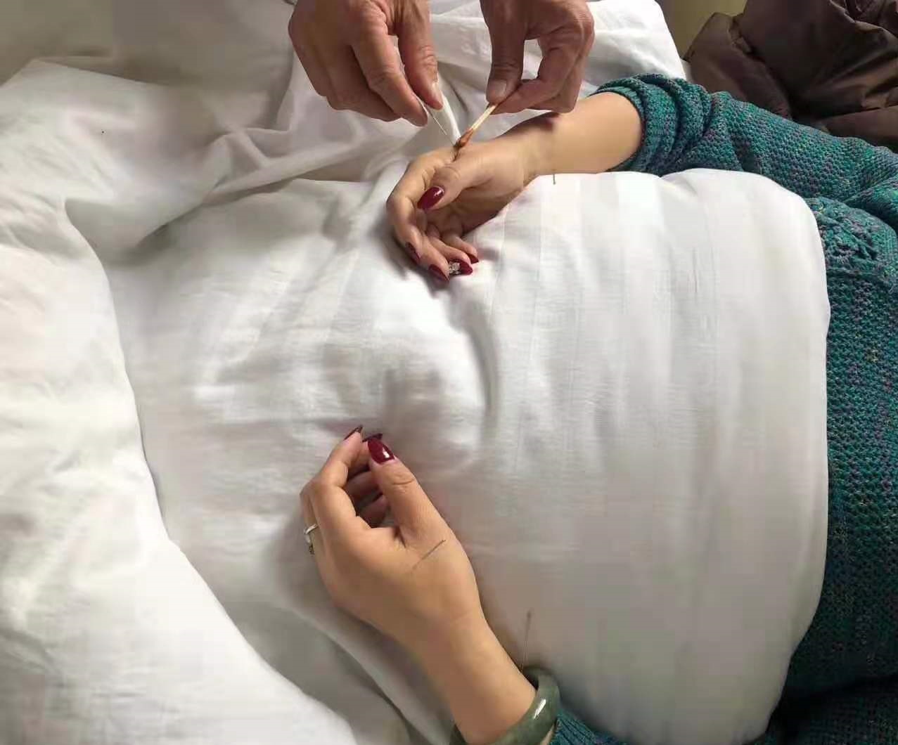 新乡潘剑中医针灸图